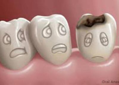 آیا می توان پوسیدگی دندان را معکوس ساخت؟