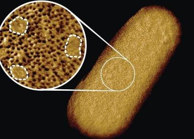 دقیق ترین تصویر از یک باکتری زنده برای شناسایی ابر میکروب ها
